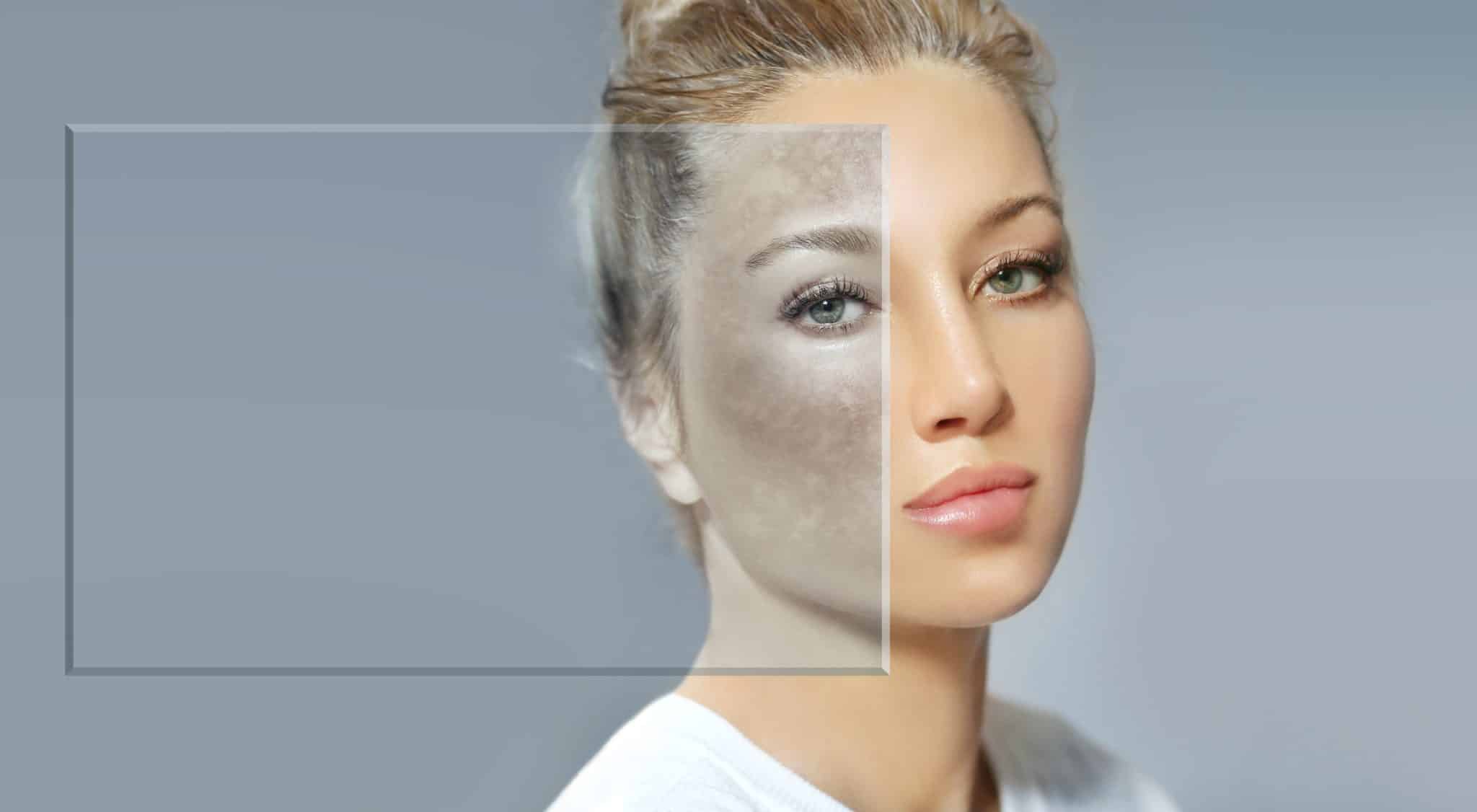 A photo of a woman’s face that illustrates how sun damage can deceptively sit under the surface of our skin.