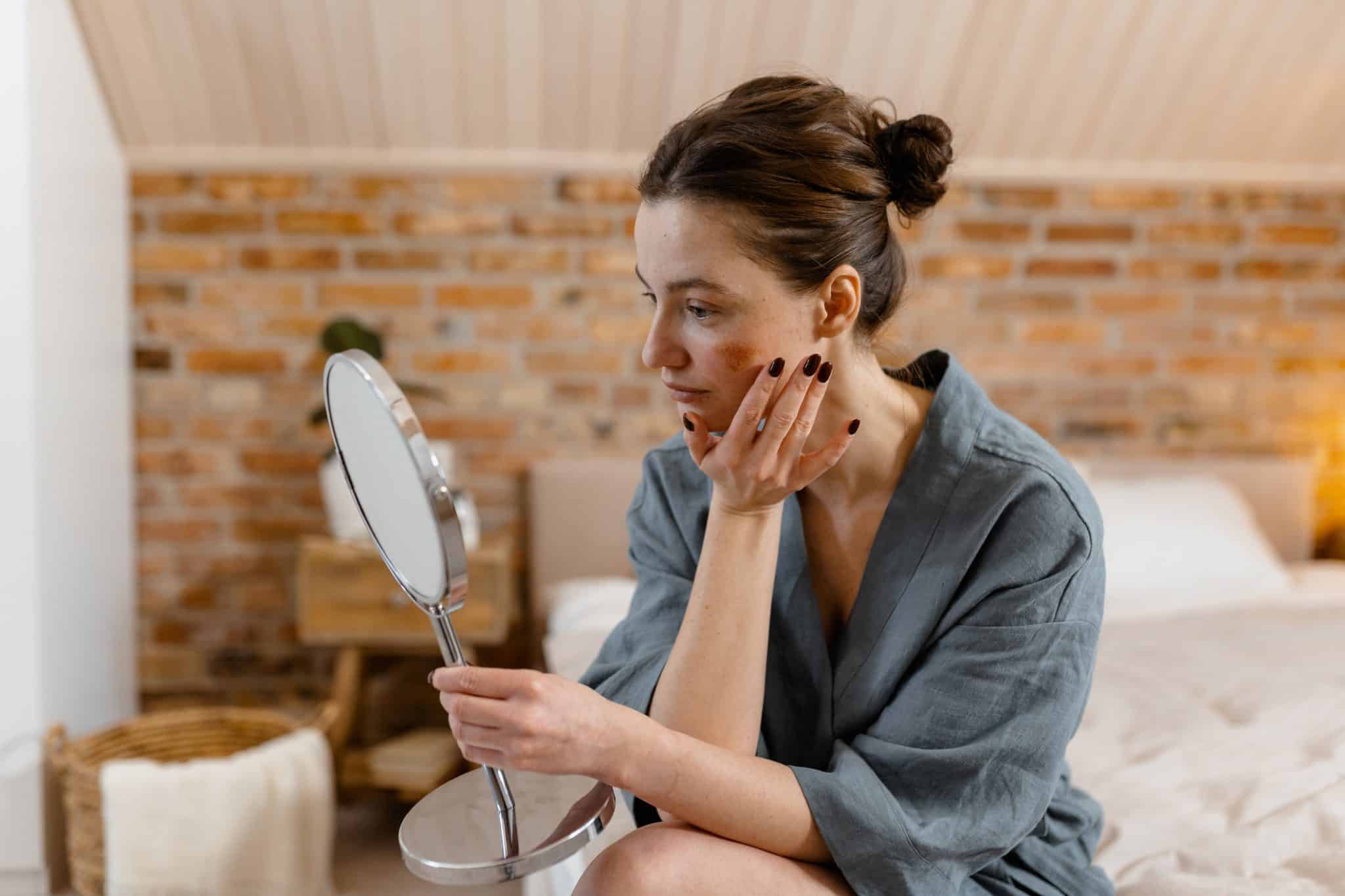 Woman in a sunny bedroom holding a large mirror to check facial redness while considering rosacea treatment options.